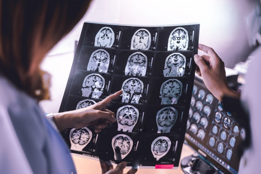 智慧醫療Medical image