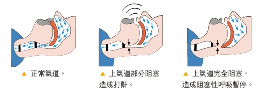 打鼾